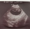  - Gestation confirmée, des bébés attendus au mois d'août !